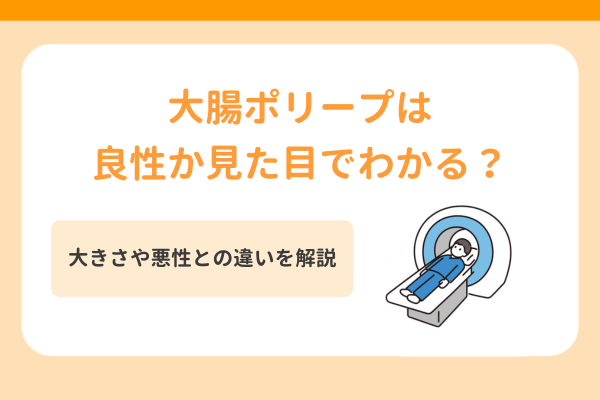 大腸ポリープは良性か見た目でわかる?大きさや悪性との違いを解説