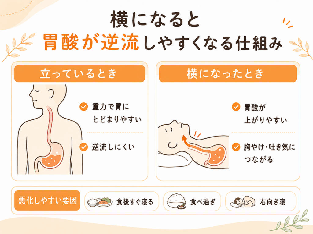 横になると遺産が逆流しやすくなる仕組み