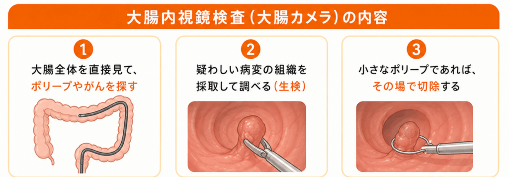 大腸内視鏡検査(大腸カメラ)