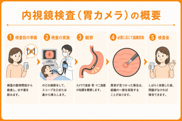 内視鏡検査（胃カメラ）