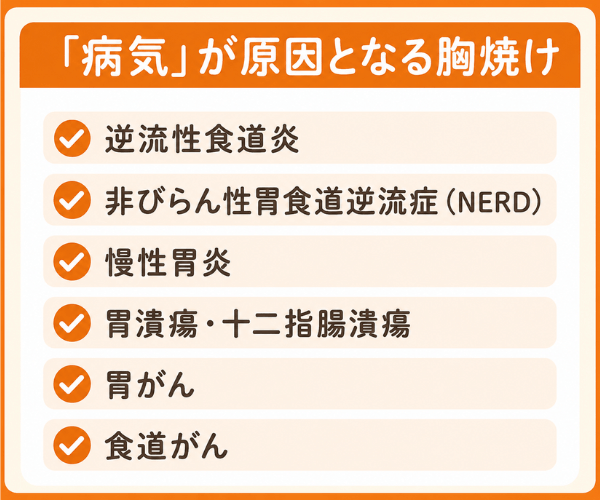 「病気」が原因となる胸焼け