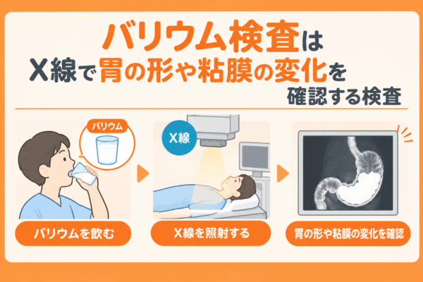 バリウム検査はX線で胃の形や粘膜の変化を確認する検査