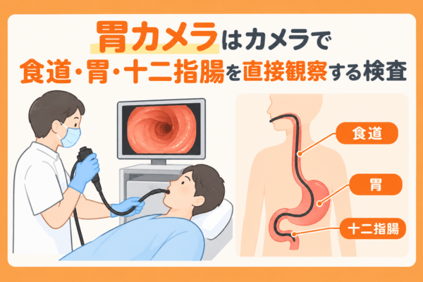 胃カメラはカメラで食道・胃・十二指腸を直接観察する検査