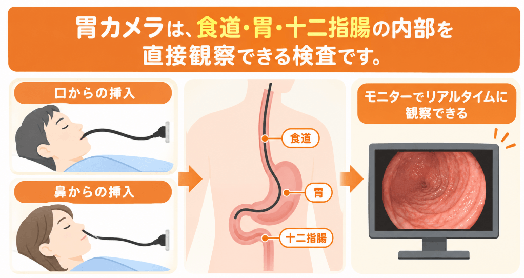 胃カメラ（上部消化管内視鏡）検査とは