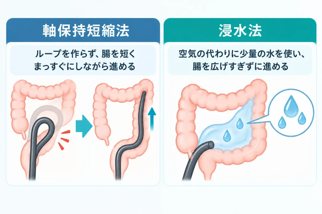 痛みを抑えるための主な挿入法