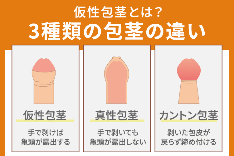 仮性包茎とは？3種類の包茎の違い