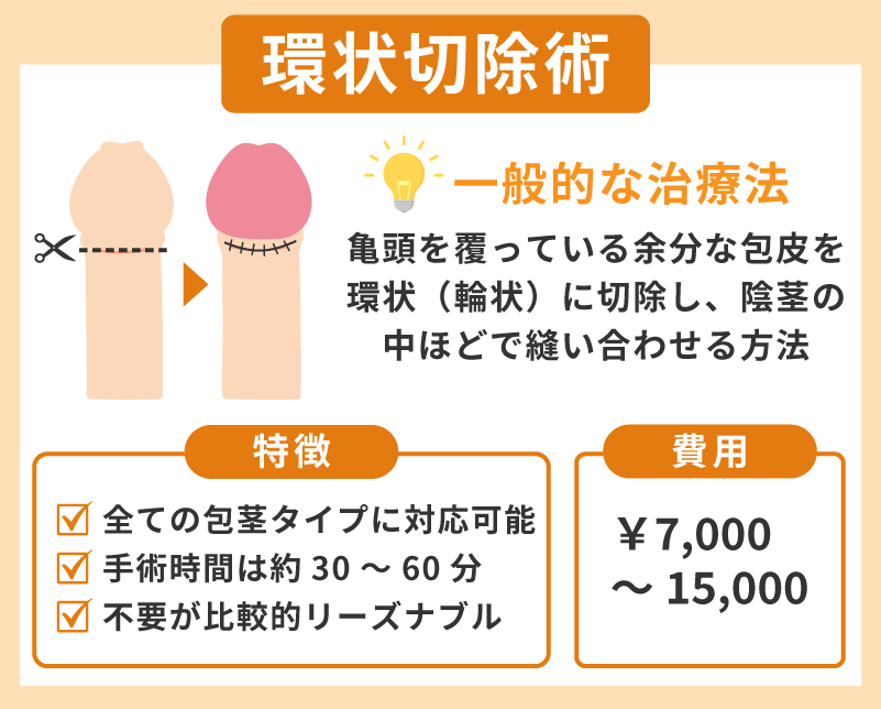 環状切除術は一般的な包茎手術