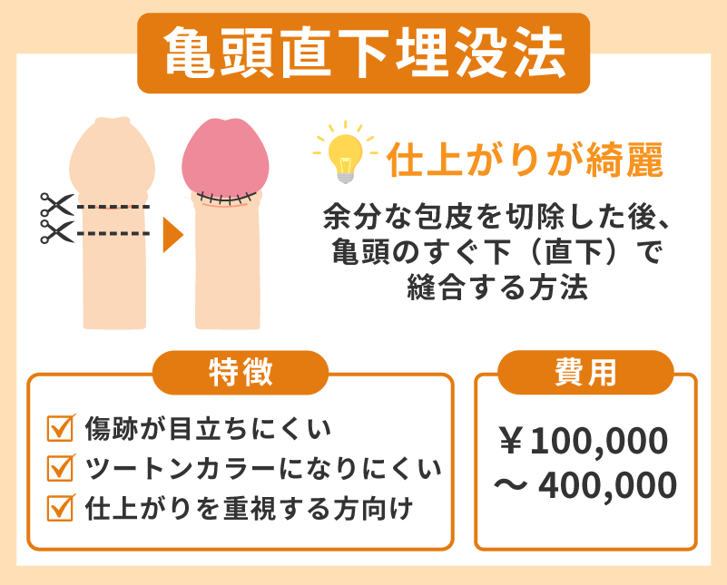亀頭直下埋没法は仕上がりの綺麗