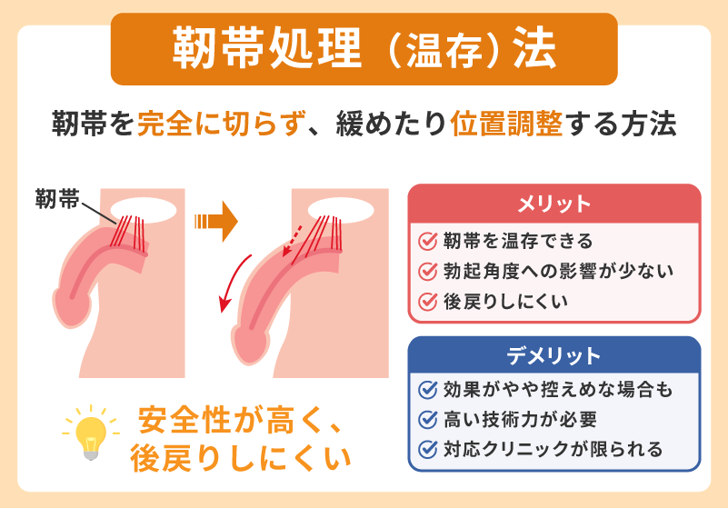 靭帯処理(温存)法