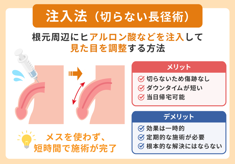 注入法(切らない長径術)
